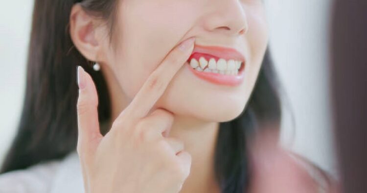 Gum Disease: What Patients Need to Know in St. Louis, MO