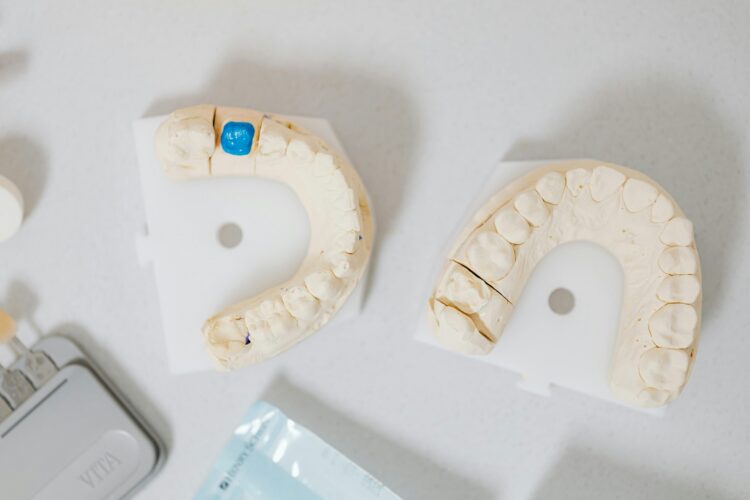 3 Tips for Preventing Cavities and Developing Healthy Dental Habits in St. Louis, MO